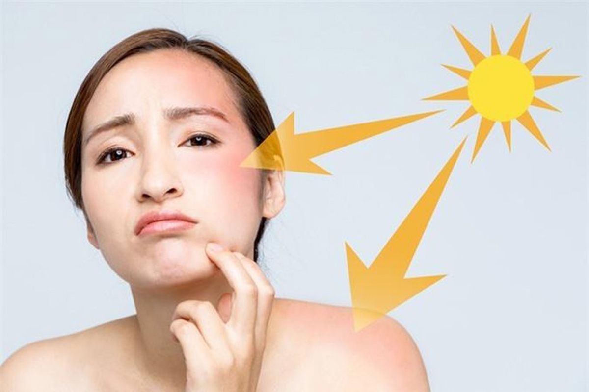 Điều gì xảy ra khi da thường xuyên tiếp xúc nắng gắt?