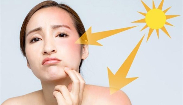 Điều gì xảy ra khi da thường xuyên tiếp xúc nắng gắt?