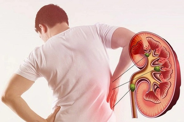 Người trẻ và 5 thói quen đang âm thầm phá hủy thận mỗi ngày