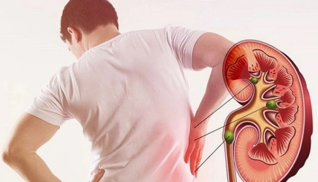 Người trẻ và 5 thói quen đang âm thầm phá hủy thận mỗi ngày