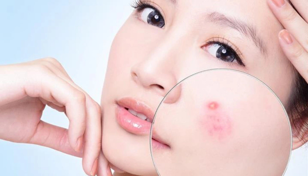 Mụn nhọt sưng đỏ: Nên để tự xẹp hay cần can thiệp?